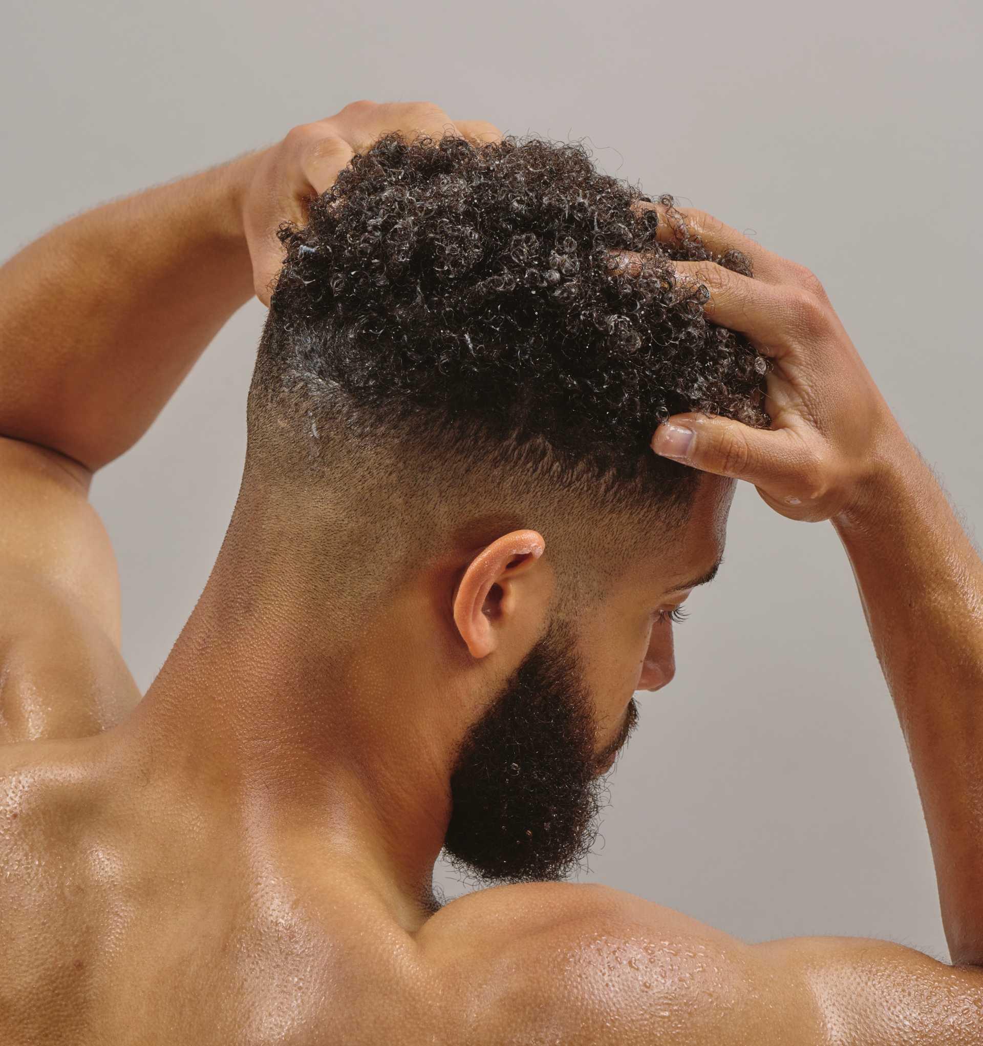 Men with Dry scalp and hair