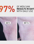 Bump Clear - Post Shave & Bump Treatment
