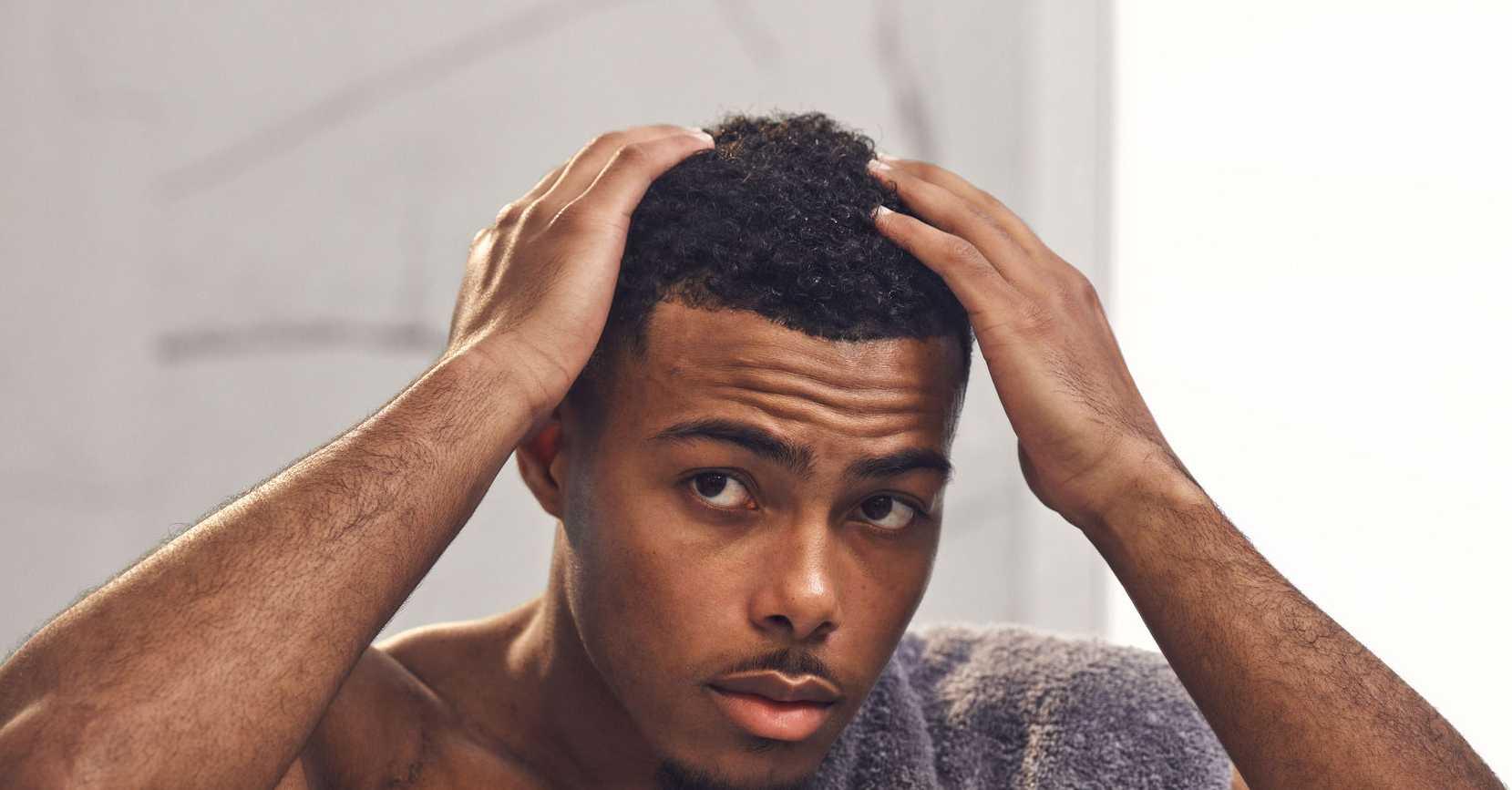 how to fix receding hairline in black men