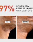 Bump Clear - Post Shave & Bump Treatment