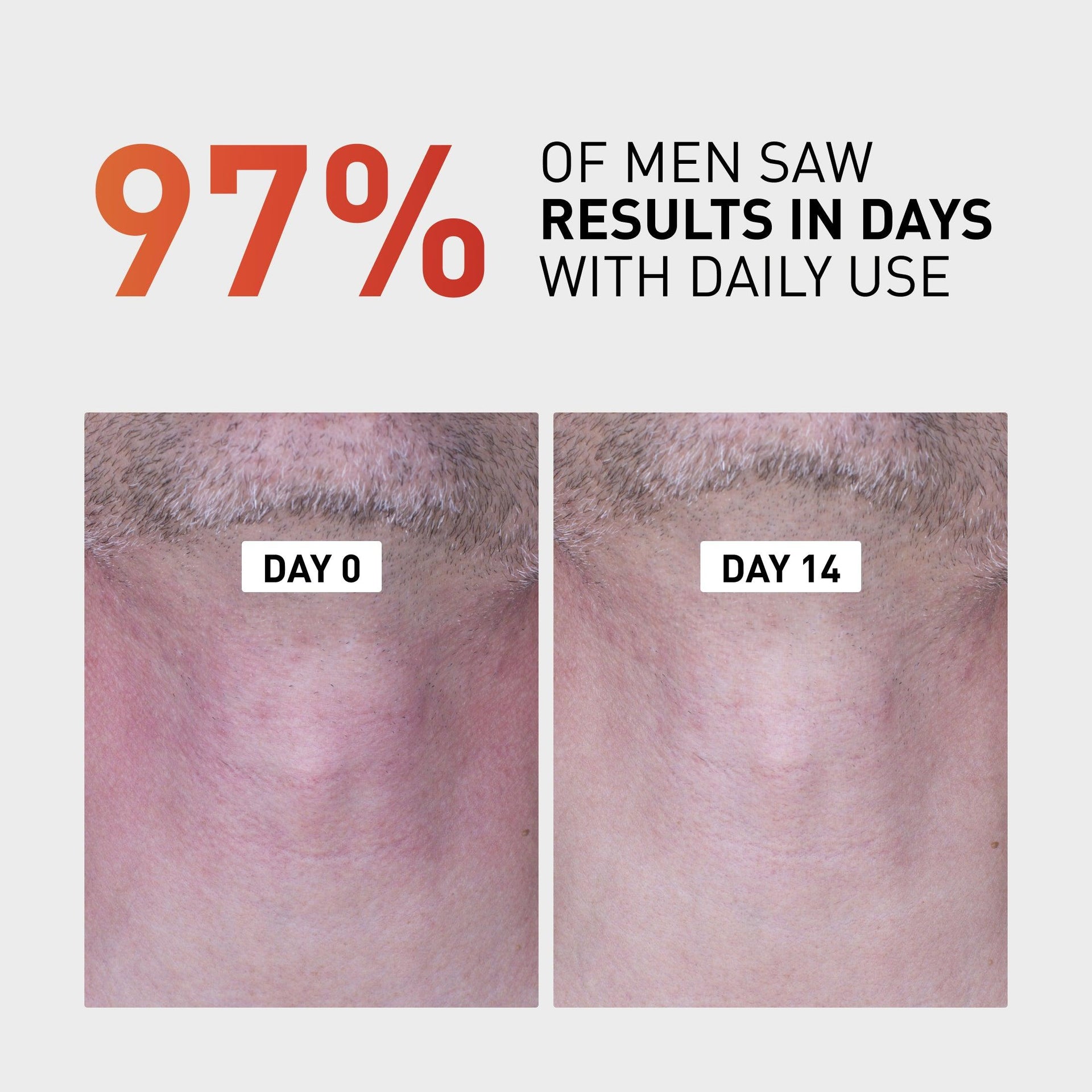 Post Shave Razor Bump Treatment & Cream | Frederick Benjamin