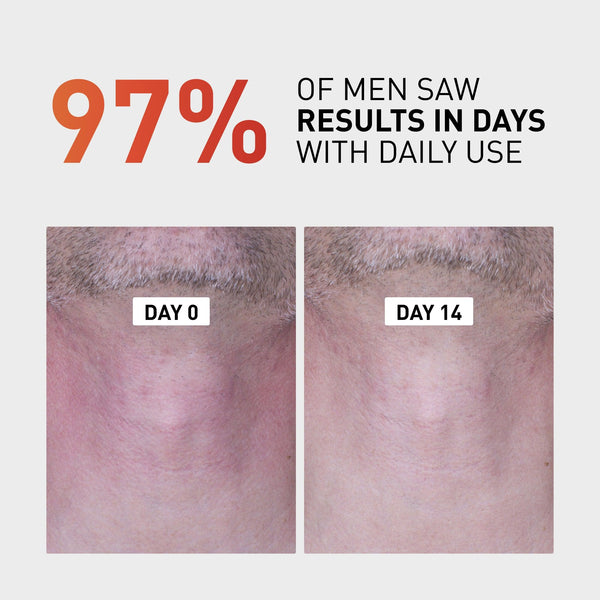 Bump Clear - Post Shave &amp; Bump Treatment